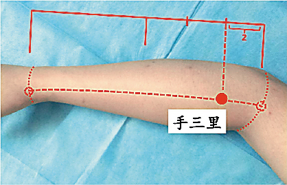 手三里穴