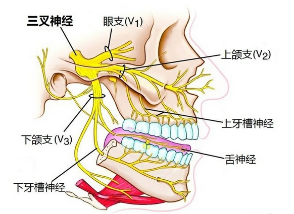 三叉神经痛属于中医“偏头痛